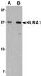 T-cell surface glycoprotein YE1/48 antibody, MBS151024, MyBioSource, Western Blot image 