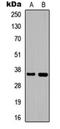 Killer Cell Immunoglobulin Like Receptor, Two Ig Domains And Long Cytoplasmic Tail 5A antibody, orb234795, Biorbyt, Western Blot image 