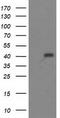 Alcohol Dehydrogenase 1B (Class I), Beta Polypeptide antibody, CF502779, Origene, Western Blot image 