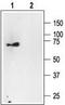 p75 ICD antibody, TA328683, Origene, Western Blot image 