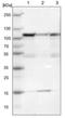 Serine/threonine-protein phosphatase 4 regulatory subunit 3A antibody, NBP1-84664, Novus Biologicals, Western Blot image 