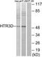 5-Hydroxytryptamine Receptor 3D antibody, TA316222, Origene, Western Blot image 