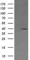 Mitogen-Activated Protein Kinase Kinase 3 antibody, TA505839BM, Origene, Western Blot image 