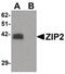 Solute Carrier Family 39 Member 2 antibody, PA5-21067, Invitrogen Antibodies, Western Blot image 