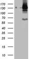 Poly(ADP-ribose) glycohydrolase antibody, LS-C798560, Lifespan Biosciences, Western Blot image 