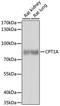 Carnitine Palmitoyltransferase 1A antibody, A5307, ABclonal Technology, Western Blot image 