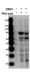 Serine/threonine-protein kinase MARK2 antibody, P02117, Boster Biological Technology, Western Blot image 