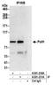 DNA Polymerase Eta antibody, A301-230A, Bethyl Labs, Immunoprecipitation image 