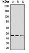 G Protein-Coupled Receptor 143 antibody, LS-C354381, Lifespan Biosciences, Western Blot image 