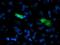 Sedoheptulokinase antibody, MA5-25622, Invitrogen Antibodies, Immunocytochemistry image 