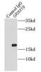 NADH:Ubiquinone Oxidoreductase Subunit A13 antibody, FNab03649, FineTest, Immunoprecipitation image 