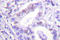 Protein Inhibitor Of Activated STAT 4 antibody, LS-C176344, Lifespan Biosciences, Immunohistochemistry paraffin image 