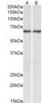 Acetylcholinesterase antibody, STJ70663, St John