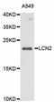 Lipocalin 2 antibody, abx126085, Abbexa, Western Blot image 