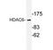 Histone Deacetylase 6 antibody, AP20236PU-N, Origene, Western Blot image 