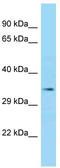 Laforin antibody, TA343303, Origene, Western Blot image 