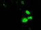 Replication Protein A2 antibody, GTX83691, GeneTex, Immunocytochemistry image 