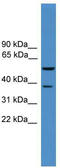 Beta-Secretase 1 antibody, TA341891, Origene, Western Blot image 