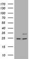 RAB21, Member RAS Oncogene Family antibody, CF505746, Origene, Western Blot image 