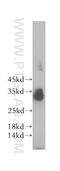 Sprouty RTK Signaling Antagonist 3 antibody, 17932-1-AP, Proteintech Group, Western Blot image 