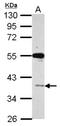 V-Set And Immunoglobulin Domain Containing 1 antibody, NBP2-20883, Novus Biologicals, Western Blot image 