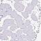 Mucin 21, Cell Surface Associated antibody, PA5-62536, Invitrogen Antibodies, Immunohistochemistry paraffin image 