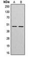 CTSE antibody, orb213807, Biorbyt, Western Blot image 