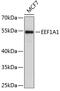 Eukaryotic Translation Elongation Factor 1 Alpha 1 antibody, 13-292, ProSci, Western Blot image 