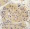Eukaryotic initiation factor 4A-I antibody, LS-C100819, Lifespan Biosciences, Immunohistochemistry paraffin image 