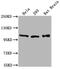 Actinin Alpha 2 antibody, CSB-PA001242LA11HU, Cusabio, Western Blot image 