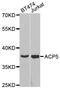Acid Phosphatase 5, Tartrate Resistant antibody, MBS129363, MyBioSource, Western Blot image 