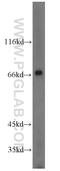 Polypeptide N-Acetylgalactosaminyltransferase 4 antibody, 12897-1-AP, Proteintech Group, Western Blot image 