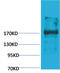Ectopic P-Granules Autophagy Protein 5 Homolog antibody, GTX34367, GeneTex, Western Blot image 