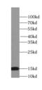Small Nuclear Ribonucleoprotein D2 Polypeptide antibody, FNab08074, FineTest, Western Blot image 
