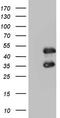 FosB Proto-Oncogene, AP-1 Transcription Factor Subunit antibody, LS-C339189, Lifespan Biosciences, Western Blot image 