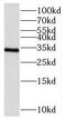 Cilia And Flagella Associated Protein 298 antibody, FNab01091, FineTest, Western Blot image 