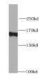 Mitogen-activated protein kinase-binding protein 1 antibody, FNab05000, FineTest, Western Blot image 