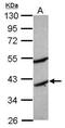 Monoacylglycerol O-Acyltransferase 2 antibody, PA5-30880, Invitrogen Antibodies, Western Blot image 