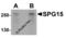 Zinc finger FYVE domain-containing protein 26 antibody, 5023, ProSci, Western Blot image 