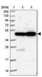 ElaC Ribonuclease Z 1 antibody, PA5-59332, Invitrogen Antibodies, Western Blot image 