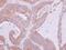 Nardilysin Convertase antibody, PA5-30106, Invitrogen Antibodies, Immunohistochemistry paraffin image 