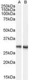 Doublecortin Domain Containing 2 antibody, MBS420857, MyBioSource, Western Blot image 