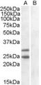 Suppressor Of Cytokine Signaling 1 antibody, MBS420696, MyBioSource, Western Blot image 