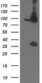 Proteasome 26S Subunit, Non-ATPase 2 antibody, CF503219, Origene, Western Blot image 