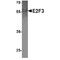 E2F Transcription Factor 3 antibody, TA349084, Origene, Western Blot image 