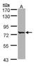Bardet-Biedl Syndrome 10 antibody, NBP1-32740, Novus Biologicals, Western Blot image 
