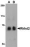 RNA-binding protein MEX3C antibody, TA306667, Origene, Western Blot image 