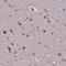 Immunoglobin Superfamily Member 21 antibody, HPA044535, Atlas Antibodies, Immunohistochemistry frozen image 