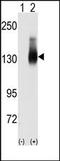 Jagged Canonical Notch Ligand 2 antibody, AP13110PU-N, Origene, Western Blot image 