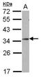 Goosecoid Homeobox antibody, NBP2-14972, Novus Biologicals, Western Blot image 